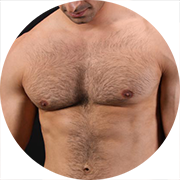 images/teases/ts396.png